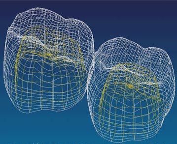 ����������� ����� � ��������